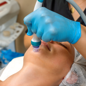 Brighter Smiles an Oregon Med Spa and Laser Center in Eugene Oregon offers Customized HydroPure Facial Procedures