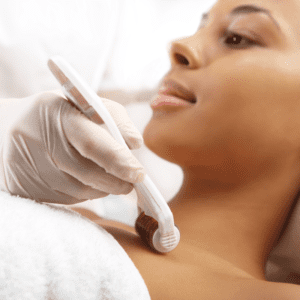 Brighter Smiles an Oregon Med Spa and Laser Center in Eugene Oregon offers Customized Microneedling Procedures