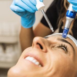 Brighter Smiles an Oregon Med Spa and Laser Center in Eugene Oregon offers Customized Microneedling Treatment