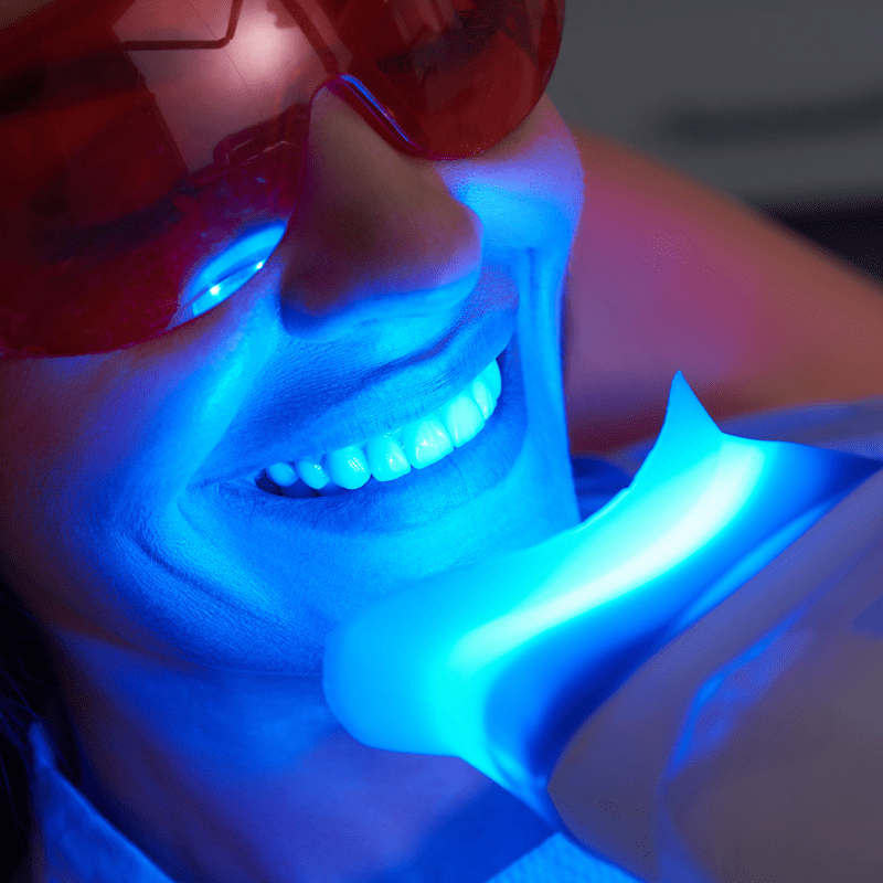 Brighter Smiles an Oregon Med Spa and Laser Center in Eugene Oregon offers In Office Teeth Whitening Service