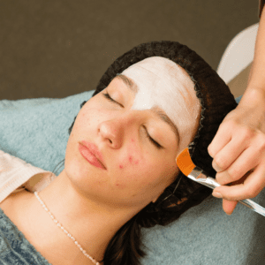 Brighter Smiles an Oregon Med Spa and Laser Center in Eugene Oregon offers Signature Acne Facial Treatment and Procedures