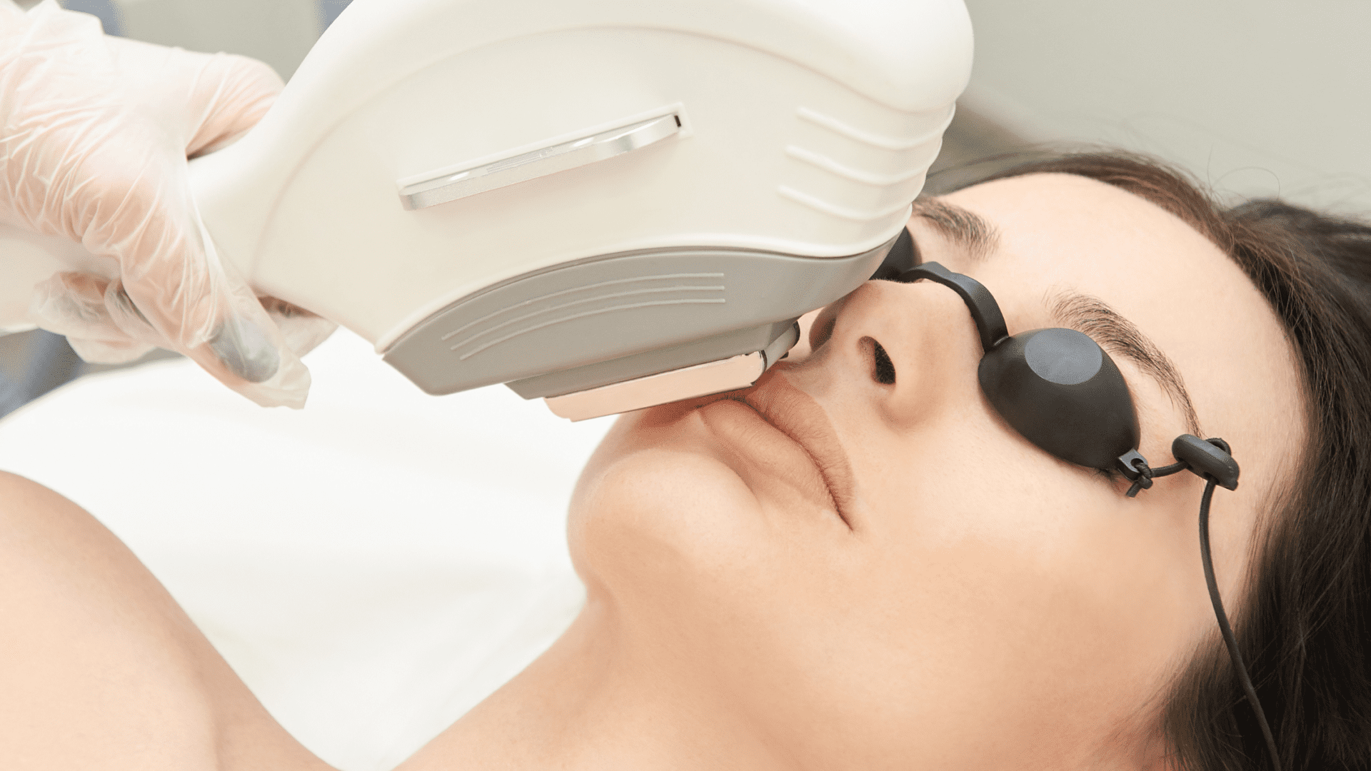 BBl fotofacial at Brighter Smiles Medpa andLaser in Eugene Oregon